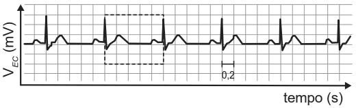 Gráfico típico de eletrocardiograma mostrando Vec em função do tempo.